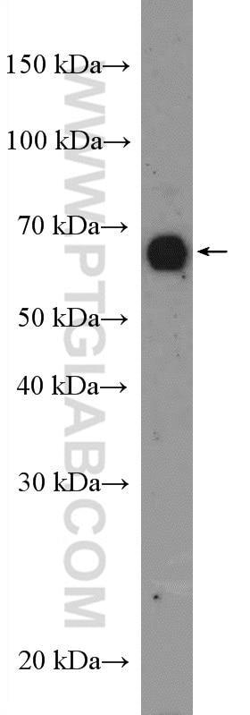 Western Blot (WB) analysis of Raji cells using BLNK Polyclonal antibody (10855-1-AP)