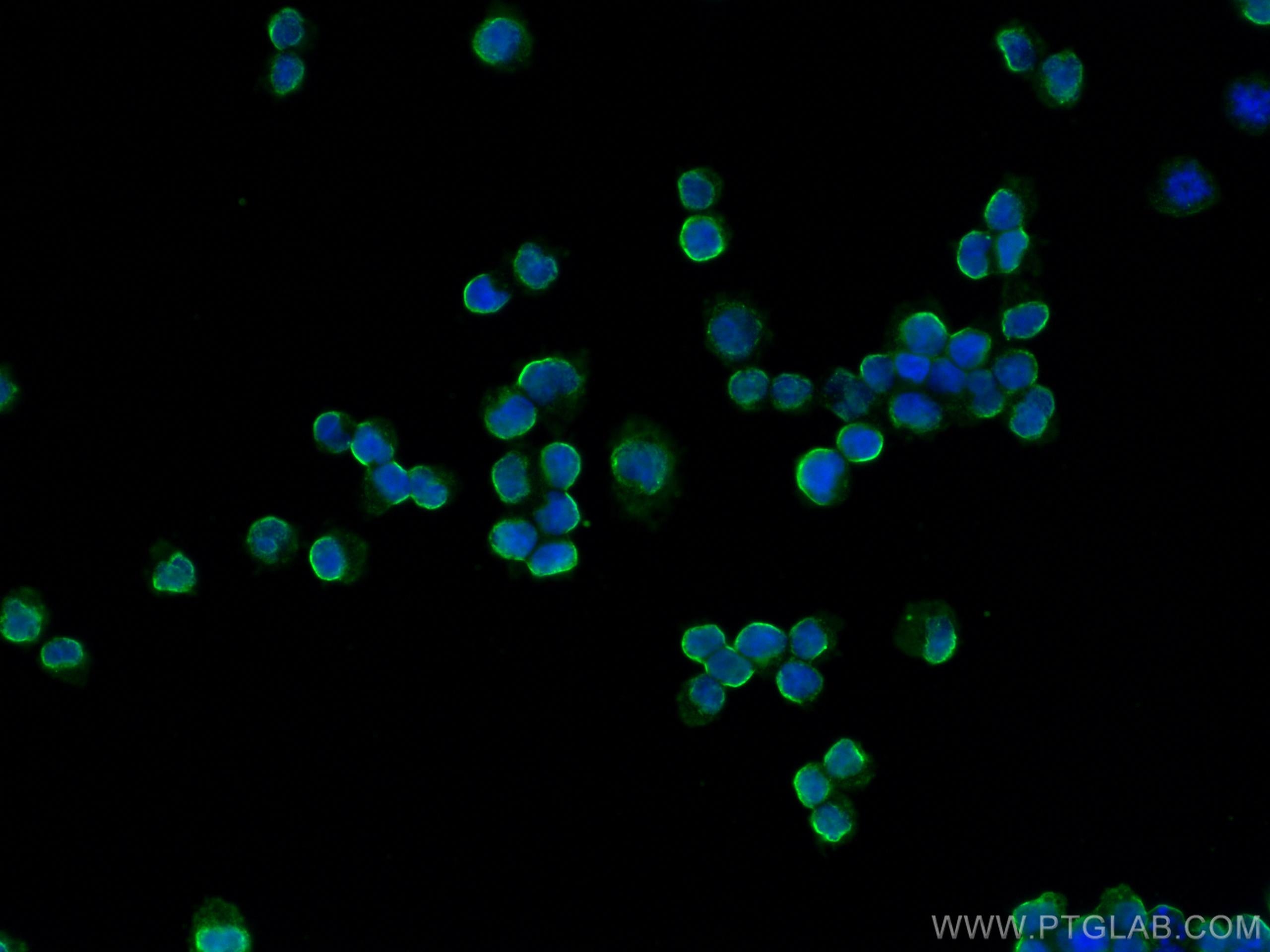 Immunofluorescence (IF) / fluorescent staining of Raji cells using BLNK Monoclonal antibody (66953-1-Ig)