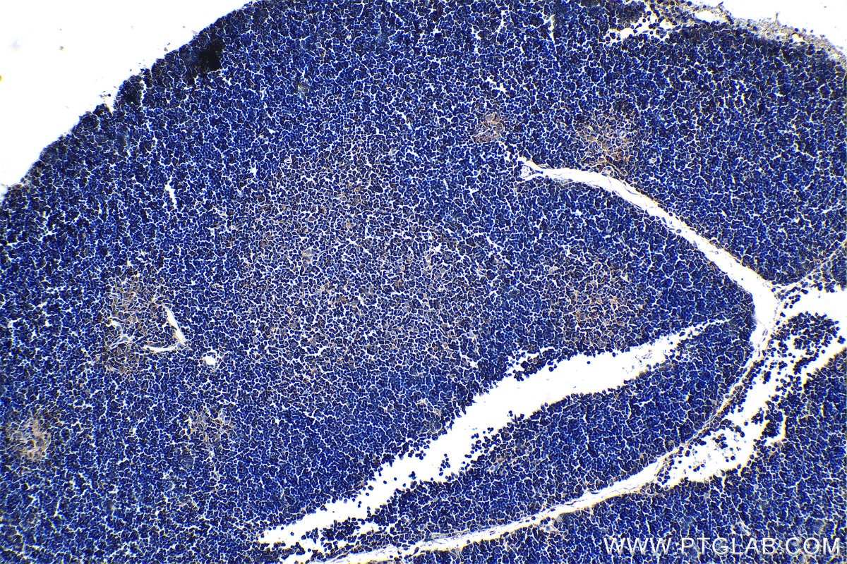 Immunohistochemistry (IHC) staining of mouse thymus tissue using BLNK Monoclonal antibody (66953-1-Ig)