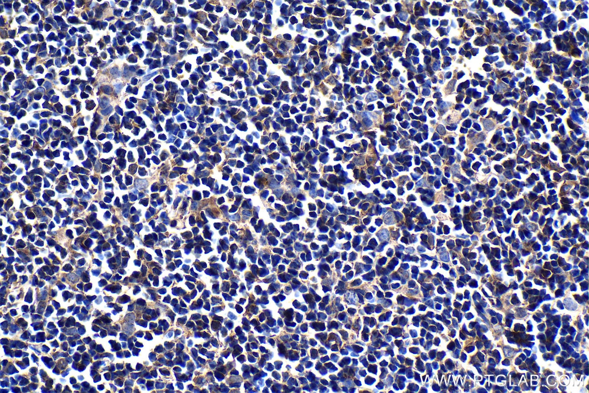 Immunohistochemistry (IHC) staining of mouse thymus tissue using BLNK Monoclonal antibody (66953-1-Ig)