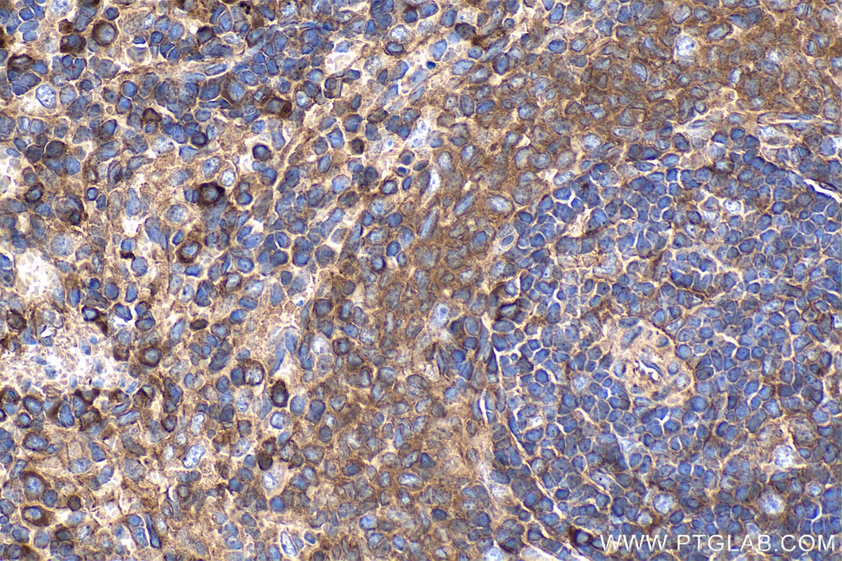 Immunohistochemistry (IHC) staining of rat spleen tissue using BLNK Monoclonal antibody (66953-1-Ig)
