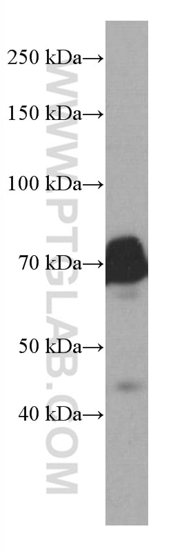 Western Blot (WB) analysis of Ramos cells using BLNK Monoclonal antibody (66953-1-Ig)