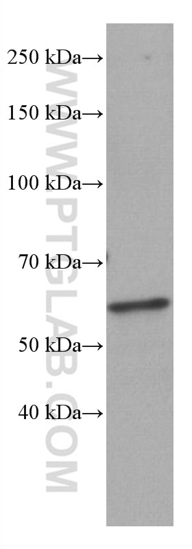 Western Blot (WB) analysis of pig spleen tissue using BLNK Monoclonal antibody (66953-1-Ig)