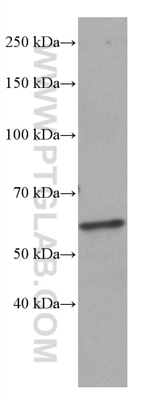 WB analysis of pig spleen using 66953-1-Ig