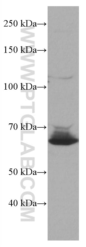Western Blot (WB) analysis of Raji cells using BLNK Monoclonal antibody (66953-1-Ig)