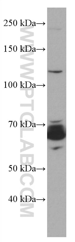 Western Blot (WB) analysis of Daudi cells using BLNK Monoclonal antibody (66953-1-Ig)