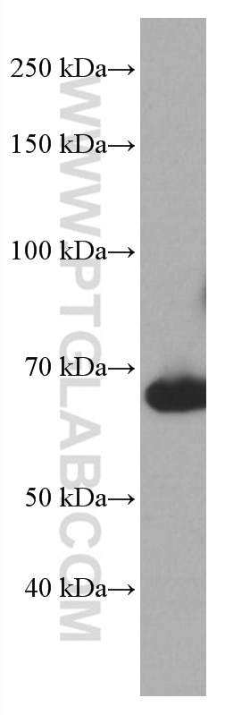 Western Blot (WB) analysis of human spleen tissue using BLNK Monoclonal antibody (66953-1-Ig)