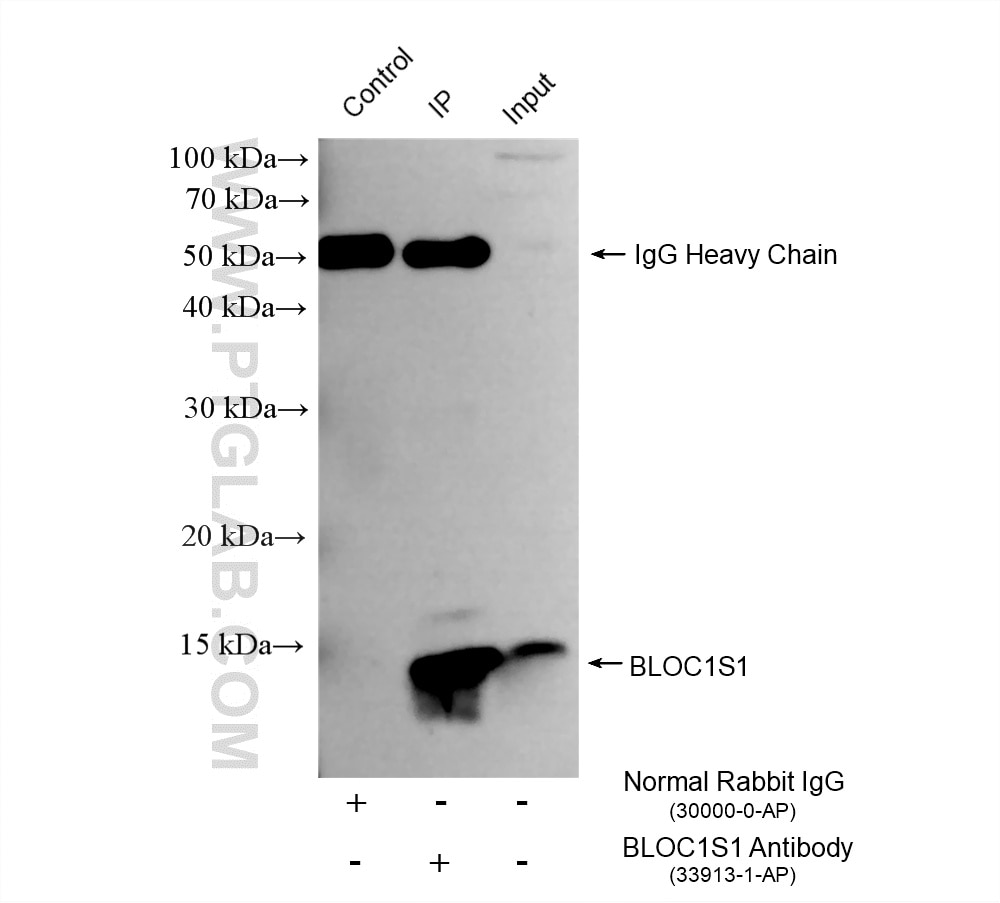 IP experiment of HEK-293 using 33913-1-AP Immunoprecipitation (IP) experiment of HEK-293 cells using BLOC1S1 Polyclonal antibody (33913-1-AP)