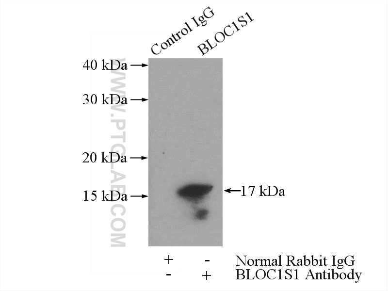 Immunoprecipitation (IP) experiment of mouse brain tissue using BLOC1S1-Specific Polyclonal antibody (19687-1-AP)