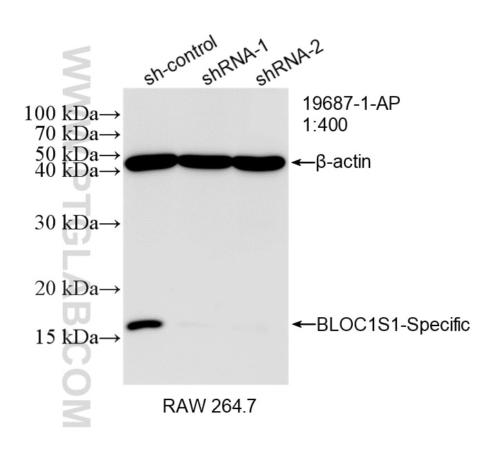 WB result of BLOC1S1-Specific antibody (19687-1-AP; 1:400; incubated at room temperature for 1.5 hours) with sh-Control and sh-BLOC1S1-Specific transfected RAW 264.7 cells. Western Blot (WB) analysis of RAW 264.7 cells using BLOC1S1-Specific Polyclonal antibody (19687-1-AP)