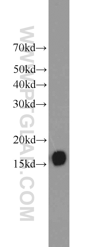 Western Blot (WB) analysis of human brain tissue using BLOC1S1-Specific Polyclonal antibody (19687-1-AP)