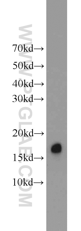 Western Blot (WB) analysis of rat brain tissue using BLOC1S1-Specific Polyclonal antibody (19687-1-AP)