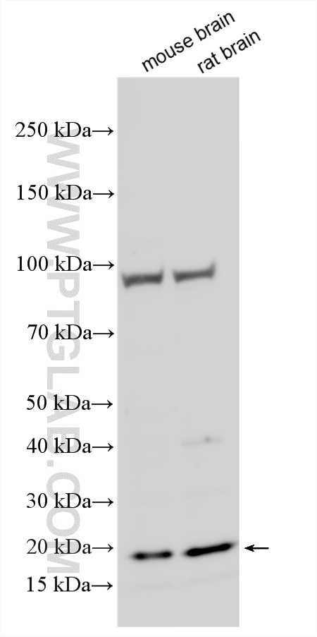 WB analysis using 12165-1-AP Western Blot (WB) analysis of various lysates using BLOC1S2 Polyclonal antibody (12165-1-AP)