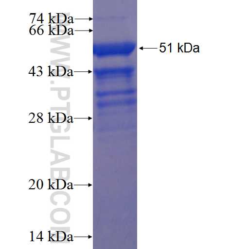 BLOC1S3 fusion protein Ag22801 SDS-PAGE