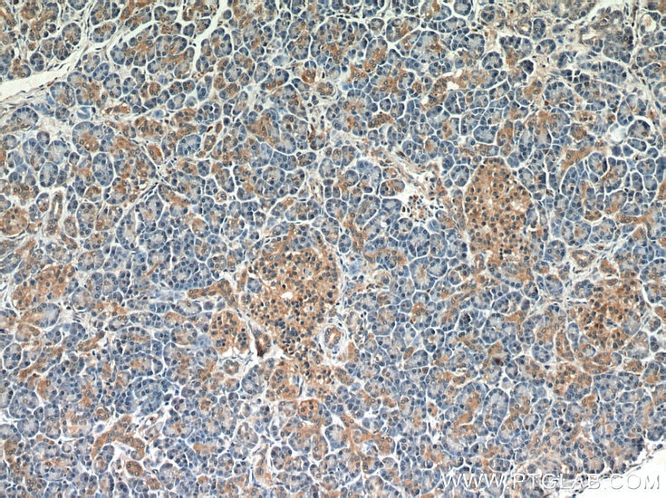 Immunohistochemistry (IHC) staining of human pancreas tissue using BLVRA Polyclonal antibody (10775-1-AP)