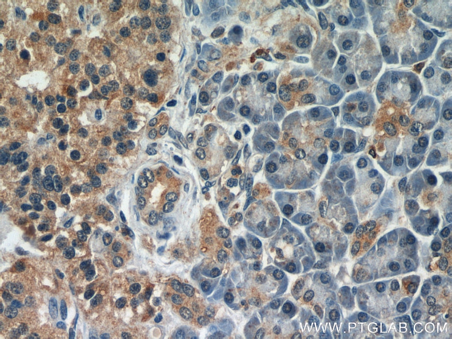 Immunohistochemistry (IHC) staining of human pancreas tissue using BLVRA Polyclonal antibody (10775-1-AP)