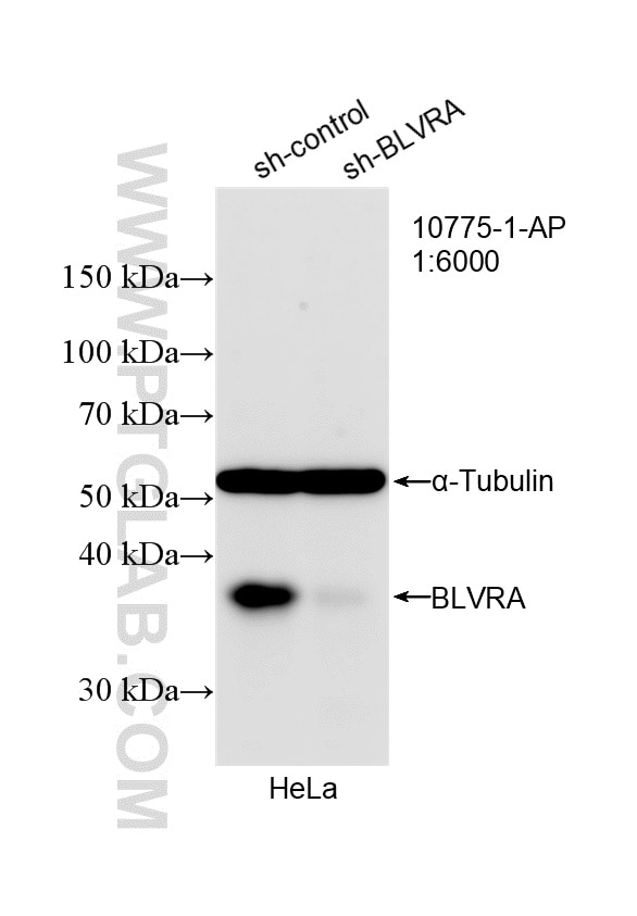 WB analysis of HeLa using 10775-1-AP Western Blot (WB) analysis of HeLa cells using BLVRA Polyclonal antibody (10775-1-AP)