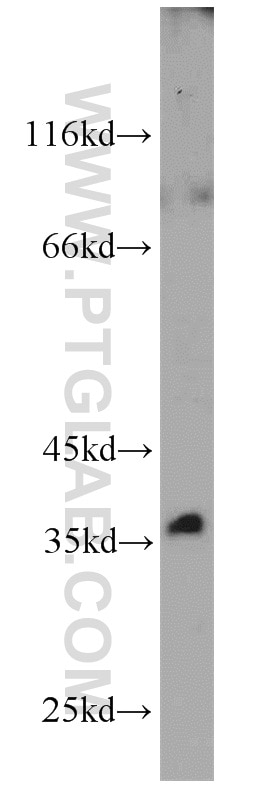 Western Blot (WB) analysis of mouse liver tissue using BLVRA Polyclonal antibody (10775-1-AP)
