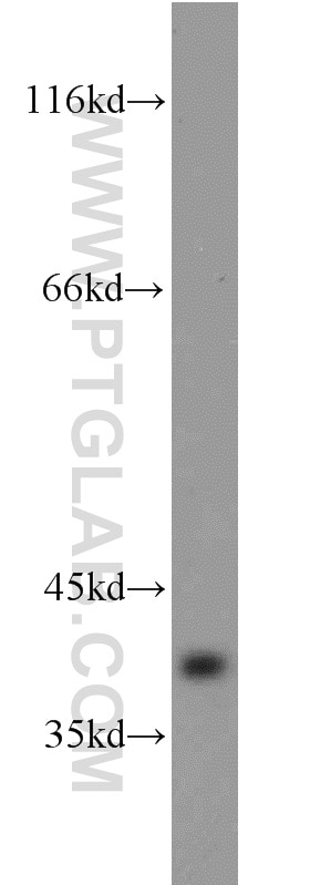 Western Blot (WB) analysis of L02 cells using BLVRA Polyclonal antibody (10775-1-AP)