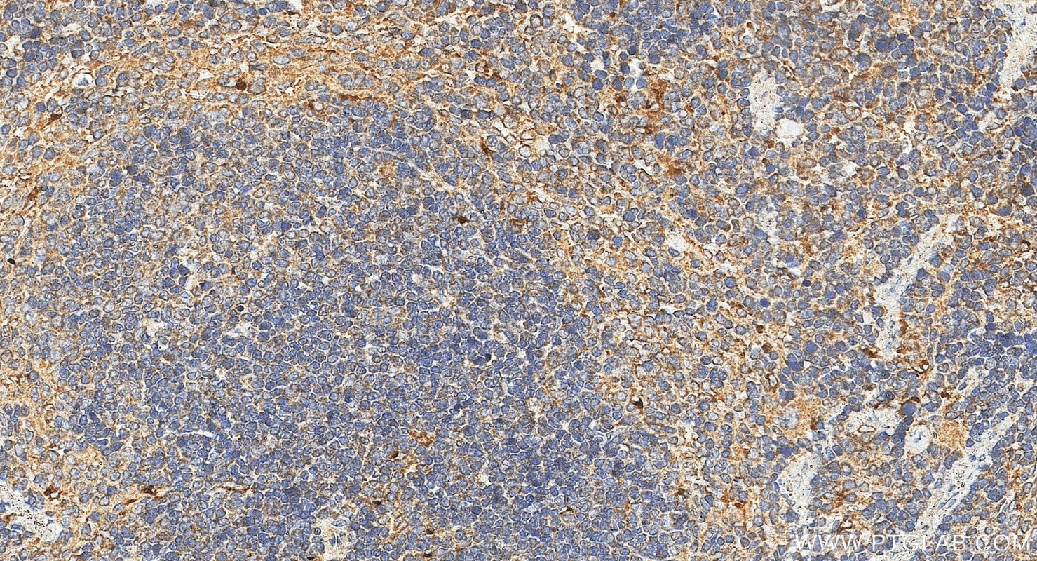IHC staining of mouse spleen using 88427-1-RR Immunohistochemistry (IHC) staining of mouse spleen tissue using BLVRA Recombinant monoclonal antibody (88427-1-RR)