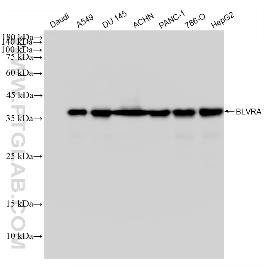 WB analysis using 88427-1-RR Western Blot (WB) analysis of various lysates using BLVRA Recombinant monoclonal antibody (88427-1-RR)