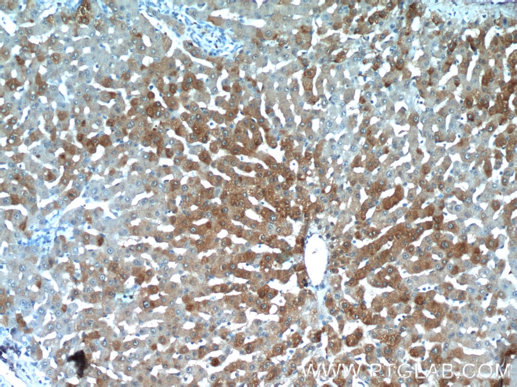 Immunohistochemistry (IHC) staining of human liver tissue using BLVRB Polyclonal antibody (17727-1-AP)