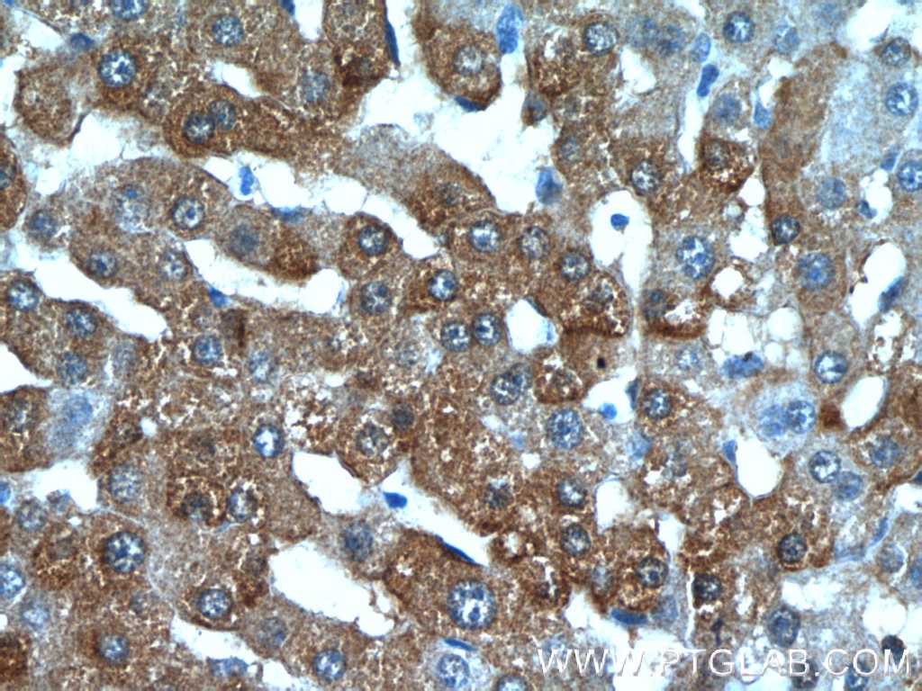 Immunohistochemistry (IHC) staining of human liver tissue using BLVRB Polyclonal antibody (17727-1-AP)