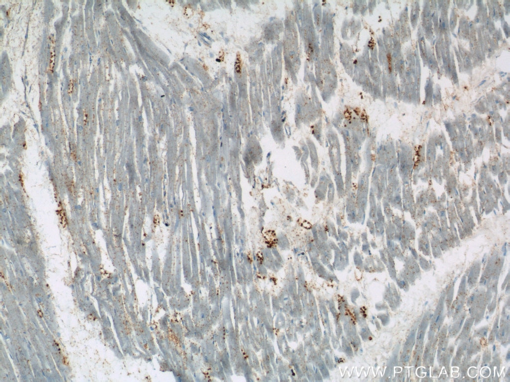 Immunohistochemistry (IHC) staining of human heart tissue using BLVRB Polyclonal antibody (17727-1-AP)