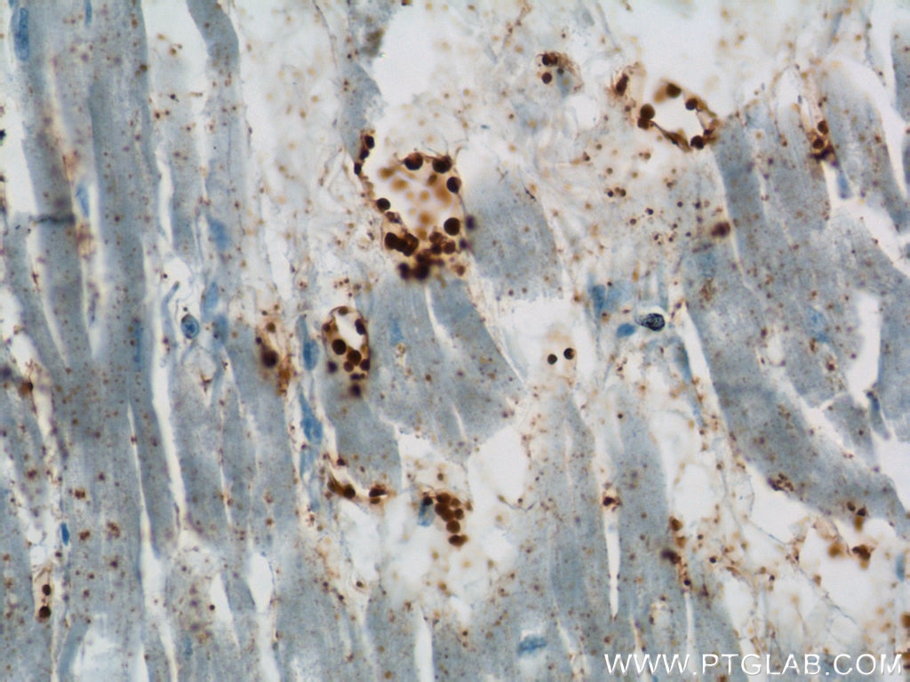 Immunohistochemistry (IHC) staining of human heart tissue using BLVRB Polyclonal antibody (17727-1-AP)