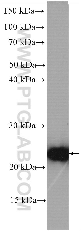 Western Blot (WB) analysis of L02 cells using BLVRB Polyclonal antibody (17727-1-AP)