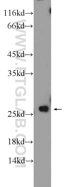 Western Blot (WB) analysis of rat liver tissue using BLVRB Polyclonal antibody (17727-1-AP)