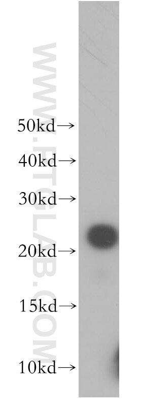 Western Blot (WB) analysis of human liver tissue using BLVRB Polyclonal antibody (17727-1-AP)