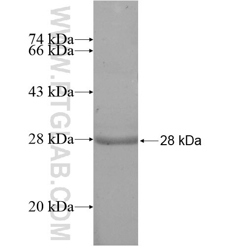 BLVRB fusion protein Ag12101 SDS-PAGE