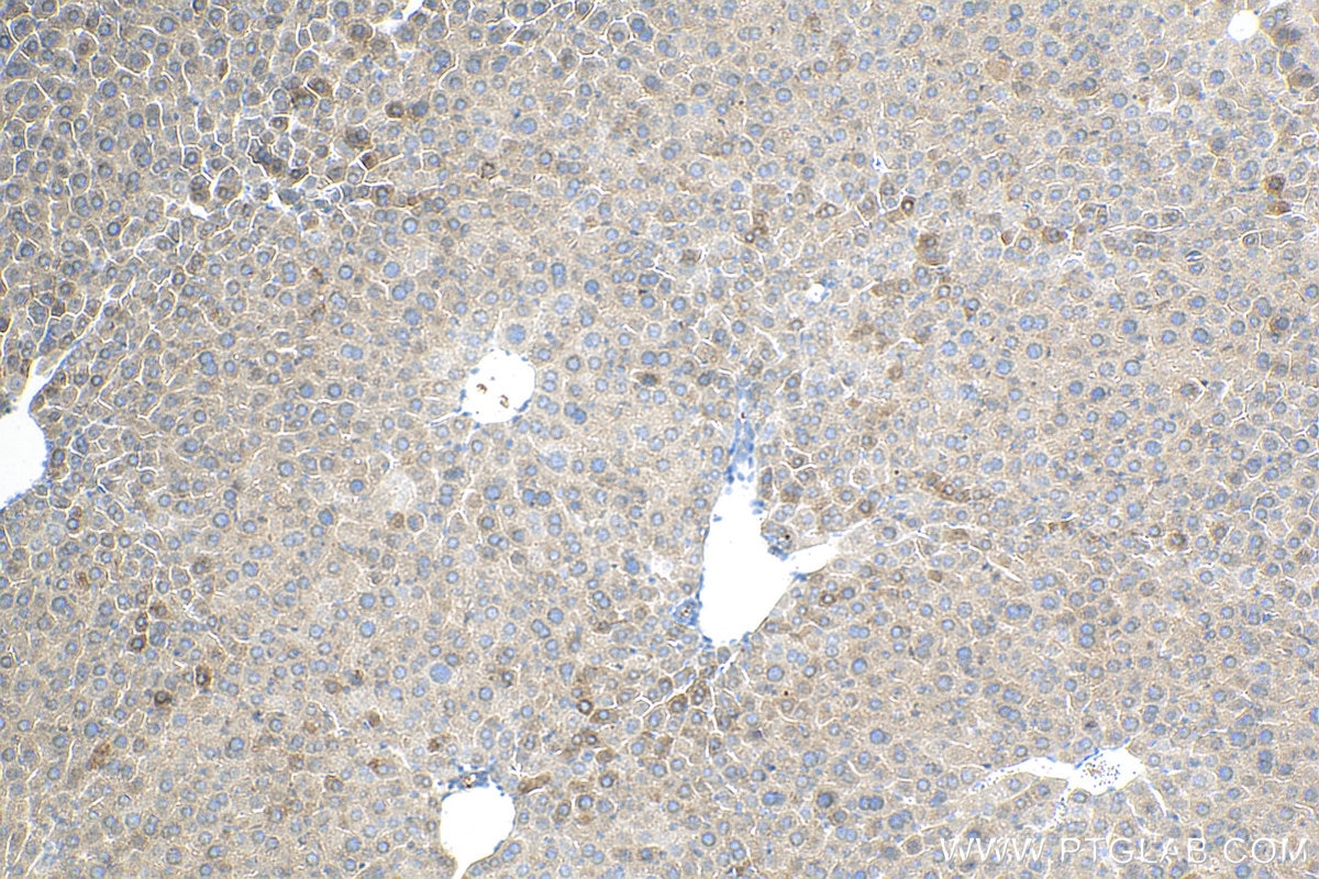 Immunohistochemistry (IHC) staining of mouse liver tissue using BLZF1 Polyclonal antibody (16354-1-AP)