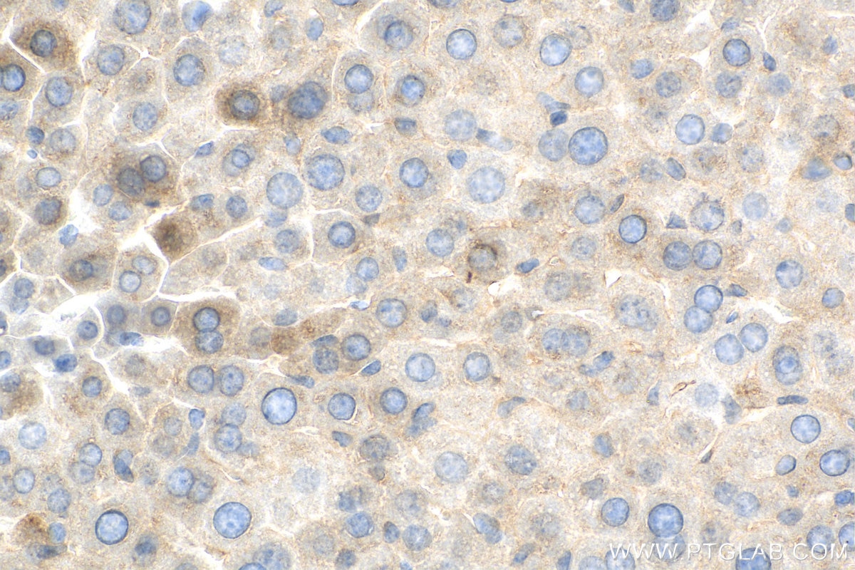 Immunohistochemistry (IHC) staining of mouse liver tissue using BLZF1 Polyclonal antibody (16354-1-AP)