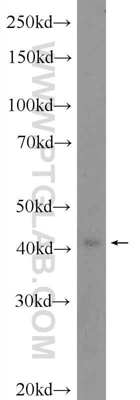 Western Blot (WB) analysis of Jurkat cells using BLZF1 Polyclonal antibody (16354-1-AP)