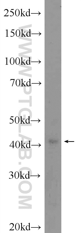 WB analysis of Jurkat using 16354-1-AP