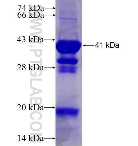 BLZF1 fusion protein Ag9879 SDS-PAGE