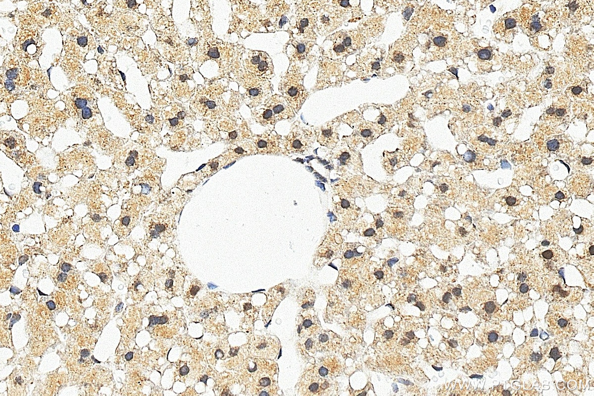 IHC staining of mouse liver using RMX00100 Immunohistochemistry (IHC) staining of mouse liver tissue using Multi-rAb® BMAL1 Multi-Recombinant antibody (RMX00100)