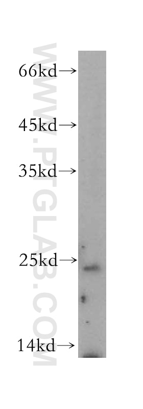 Western Blot (WB) analysis of HEK-293 cells using BMF Polyclonal antibody (18298-1-AP)