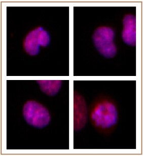 BMI-1 antibody (mAb) tested by Immunofluorescence. Formaldehyde fixed HeLa cells stained with BMI-1 antibody at a 0.5 ug/ml dilution. BMI-1 antibody (mAb) tested by Immunofluorescence. Formaldehyde fixed HeLa cells stained with BMI-1 antibody at a 0.5 ug/ml dilution.