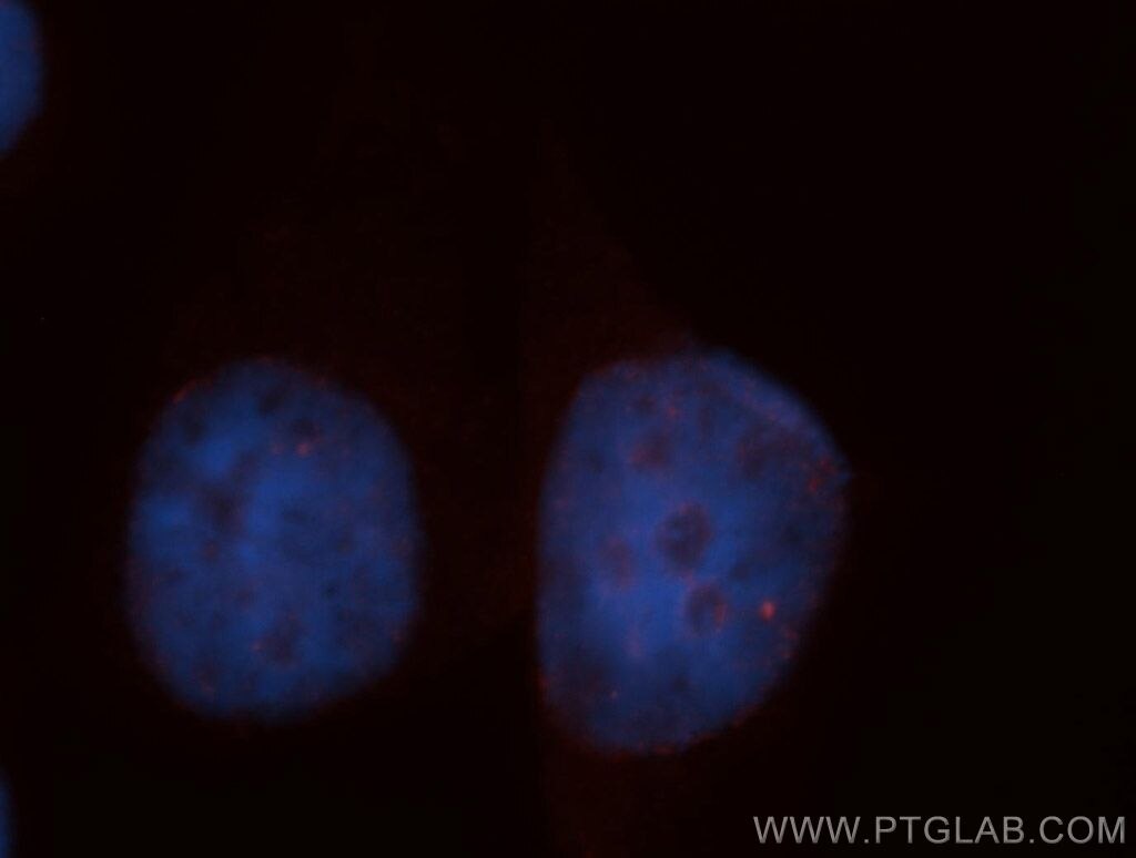 Immunofluorescence (IF) / fluorescent staining of HepG2 cells using BMI1 Polyclonal antibody (10832-1-AP)