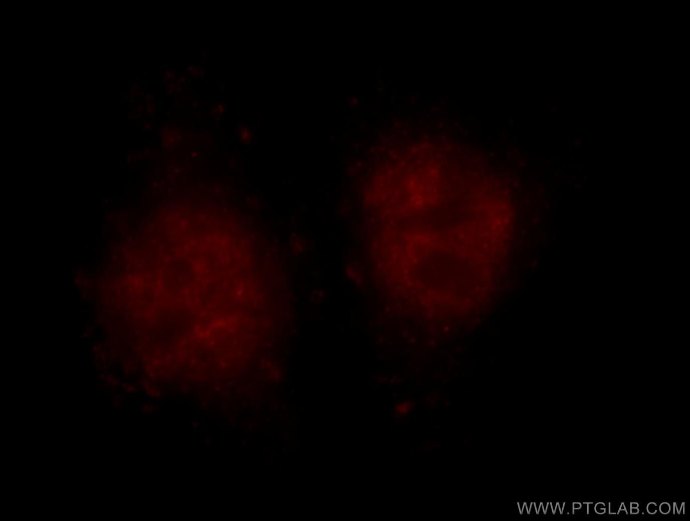 Immunofluorescence (IF) / fluorescent staining of HepG2 cells using BMI1 Polyclonal antibody (10832-1-AP)