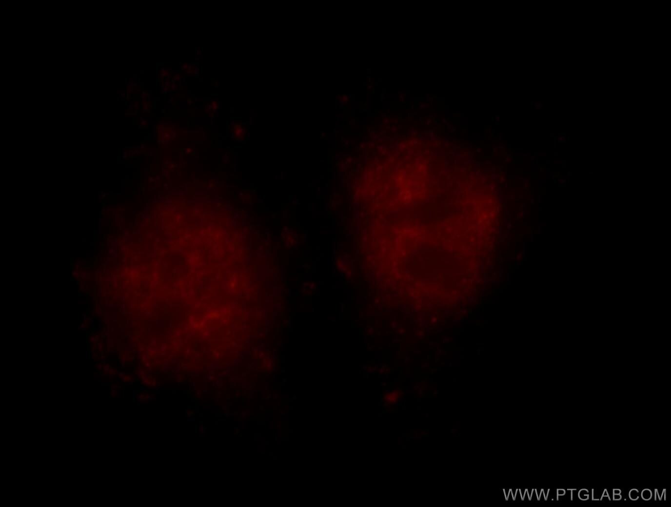 Immunofluorescence (IF) / fluorescent staining of HepG2 cells using BMI1 Polyclonal antibody (10832-1-AP)