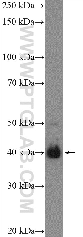 Western Blot (WB) analysis of NCCIT cells using BMI1 Polyclonal antibody (10832-1-AP)