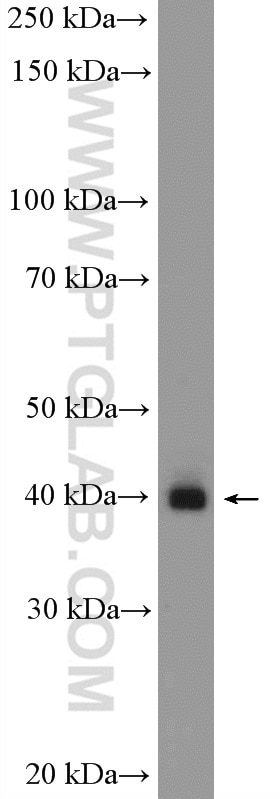 Western Blot (WB) analysis of NCCIT cells using BMI1 Polyclonal antibody (10832-1-AP)