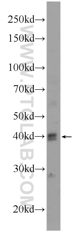 WB analysis of mouse brain using 10832-1-AP