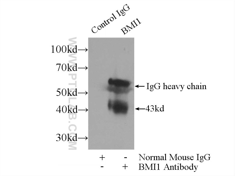 Immunoprecipitation (IP) experiment of HEK-293 cells using BMI1 Monoclonal antibody (66161-1-Ig)