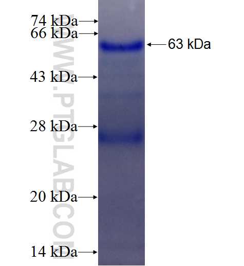 BMI1 fusion protein Ag1286 SDS-PAGE