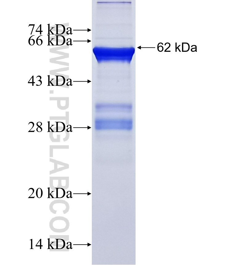 BMI1 fusion protein Ag1286 SDS-PAGE